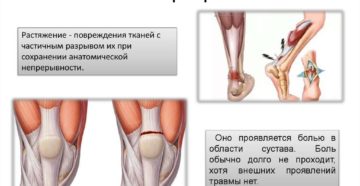 Частичное разрыв связок страховой случай или нет
